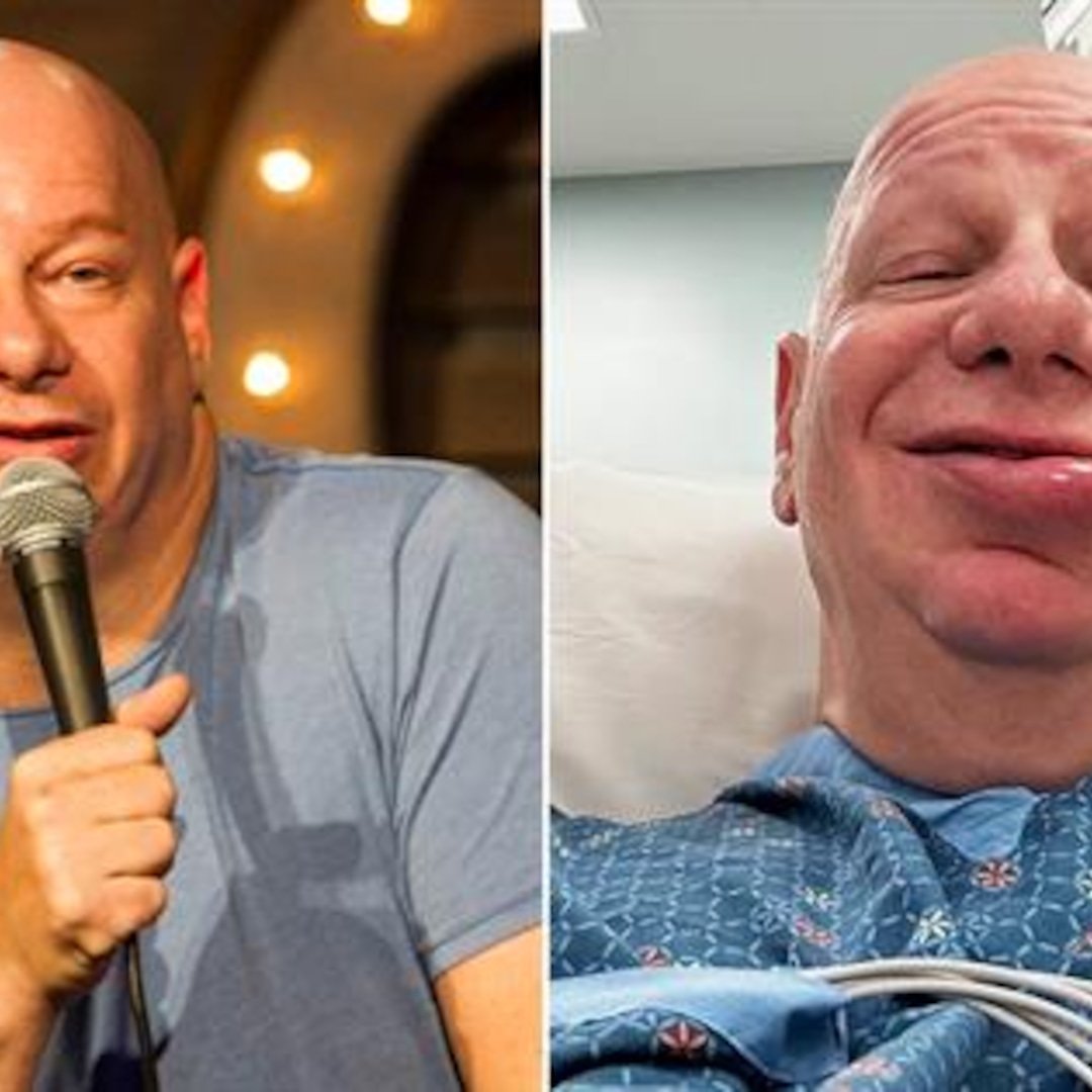 Comedian Jeff Ross Shares Shocking Results From Allergic Reaction to Ice Cream